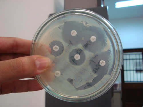 Bacteria on an Agar Plate. Bacteria from Streams are extremely hard to cultivate from The Microbiology of Streams and Rivers at www.riverscientist.com